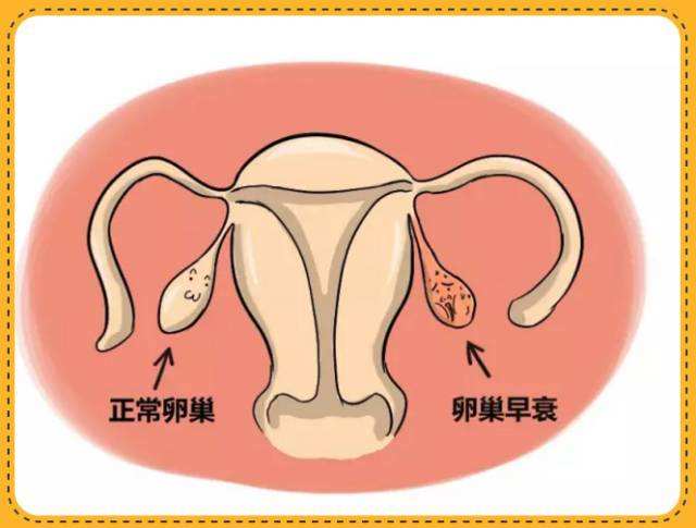 中医如何治疗卵巢早衰?