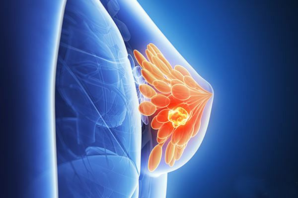 二、乳腺纤维瘤的病因是什么?