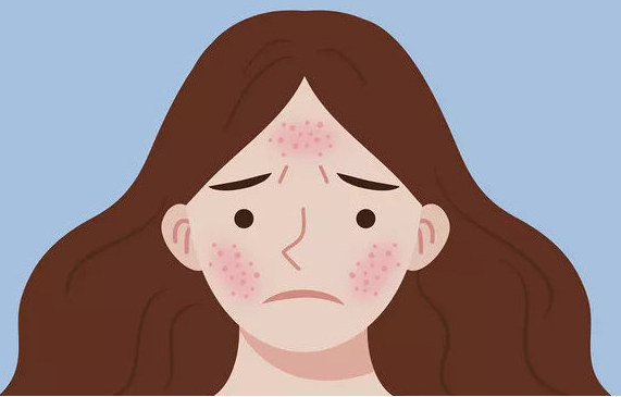 慢性湿疹急性发作时怎么治疗？