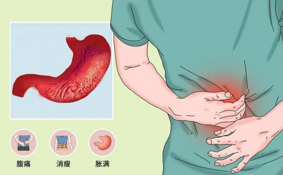 胃脘痞满不适怎么治疗？