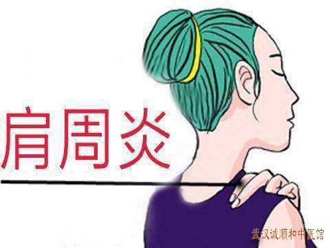 肩周炎中医有哪些治疗方法？