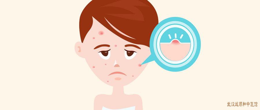 光谷一个很有名的治皮肤的老中医范平：颜面部出皮疹一直未好中医治疗效果如何?