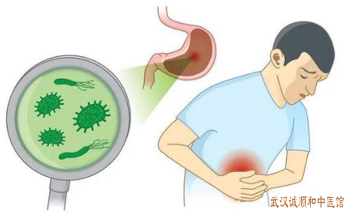 幽门螺旋杆菌中医张林茂治疗医案一则